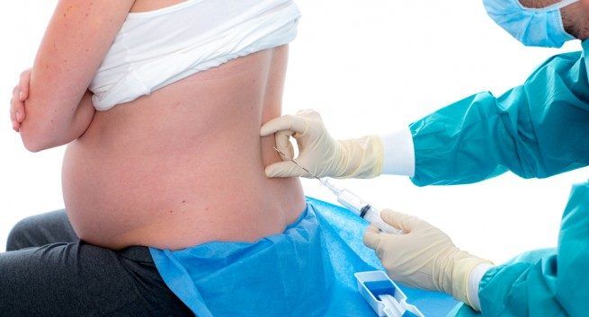 Epidural - Razones para un parto sin anestesia 02
