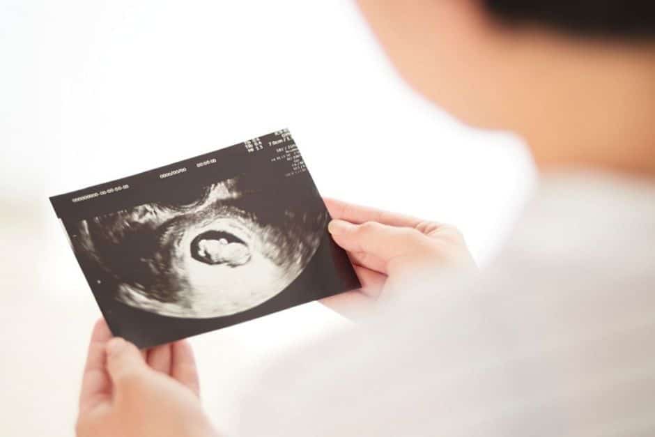 La placenta - Un órgano efímero 6 Revista Digital mamas360 Embarazo y Maternidad