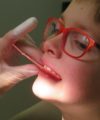 Ortodoncia | Tipos de tratamientos para niños