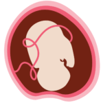 Desarrollo Fetal Mes 9 